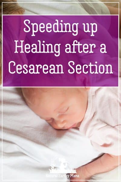 Want to heal fast from your cesarean section? You have to try these 10 genius hack to recovering faster! Have you got a planned csection? Healing from a c section is not always easy! Check out these 10 tips to make your recovery faster and less painful #csection #labor #pregnancy #nanturalearthymam